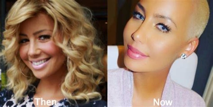 Amber Rose Before Surgery: A Comprehensive Look at Her Journey