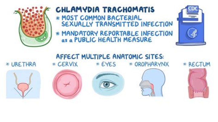 Celebrities with Chlamydia: Understanding the Impact and Breaking the Stigma