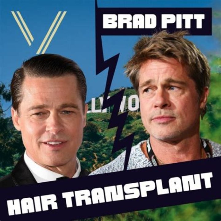 Did Brad Pitt Have Hair Transplants? Unraveling the Speculation