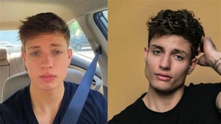 Did Matt Rife Get Plastic Surgery? Unveiling the Truth Behind the Rumors