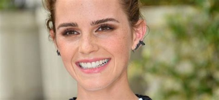 Does Emma Watson Still Wear Dentures? Unpacking a Persistent Celebrity Rumor