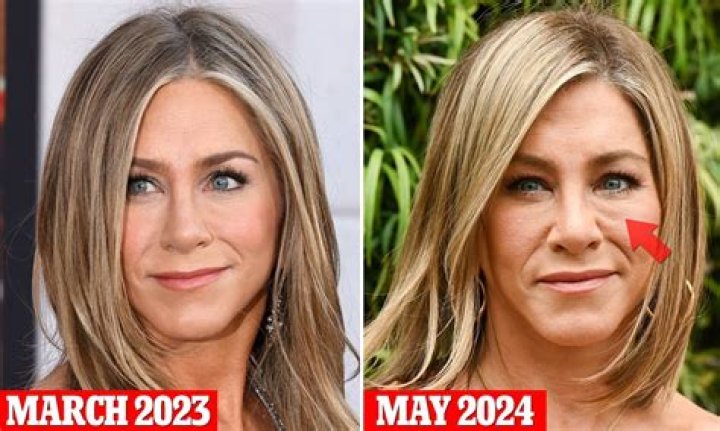 Does Jennifer Aniston Have Fillers? Unpacking the Ageless Look