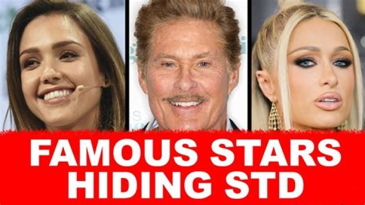 Famous Celebrities with STDs: Unveiling the Truth Behind the Headlines