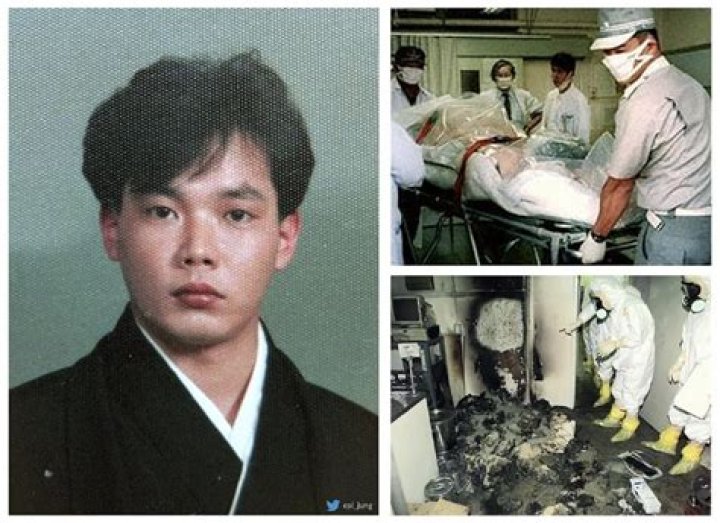 Hisashi Ouchi: The Tragic Story Behind His Real Body Photo and Its Impact on Medical Science