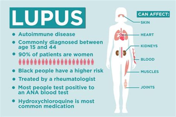 How Does Someone Get Lupus? Unraveling the Mystery