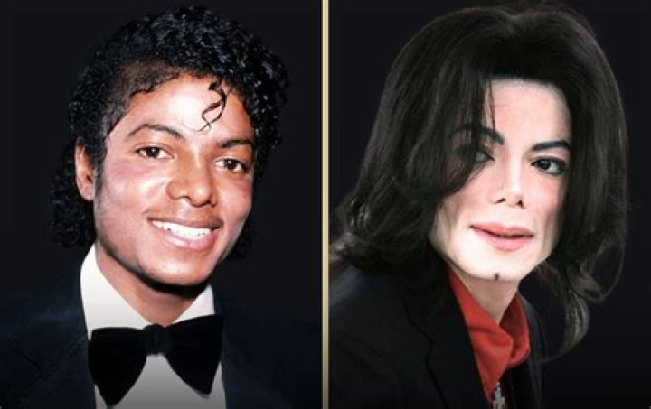 How Much Plastic Surgery Did Michael Jackson Have? Unveiling the Truth Behind the King of Pop's Transformations