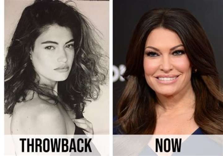 Kimberly Guilfoyle Before and After Photos: A Detailed Look at Her Transformation