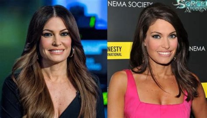 Kimberly Guilfoyle's Journey: Insights into Her Plastic Surgery Experiences