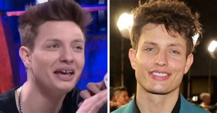 Matt Rife Pre Surgery: A Comprehensive Guide to Understanding His Journey