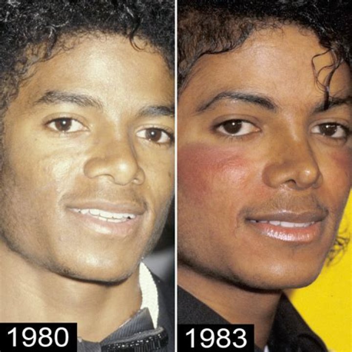 Michael Jackson Nose Job: The Truth Behind the Icon's Transformations
