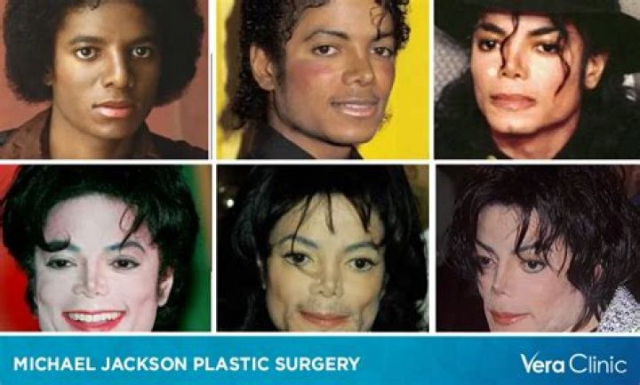 Michael Jackson Surgeries: The Truth Behind the Iconic Star's Transformations