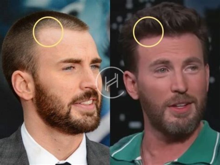 What Did Chris Evans Do to His Hair? A Look at His Iconic Looks