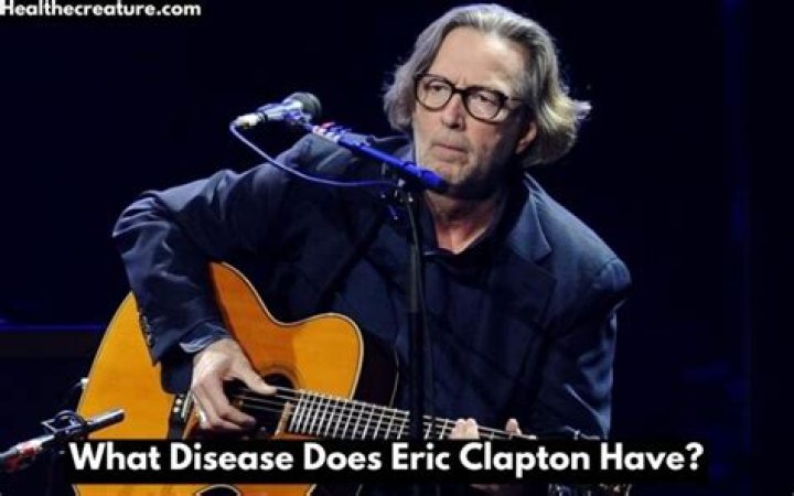 What Disease Does Eric Clapton Have? Exploring His Health Journey