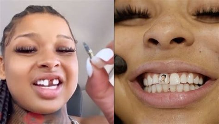 What Happened to Chrisean's Tooth? Exploring Public Curiosity About a Celebrity Smile