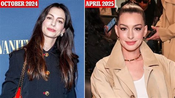 What Surgery Has Anne Hathaway Had? Unpacking the Speculation