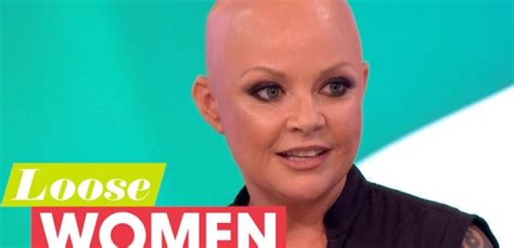 Exploring the Public's Curiosity: Who Was the Female Presenter Who Lost Her Hair?