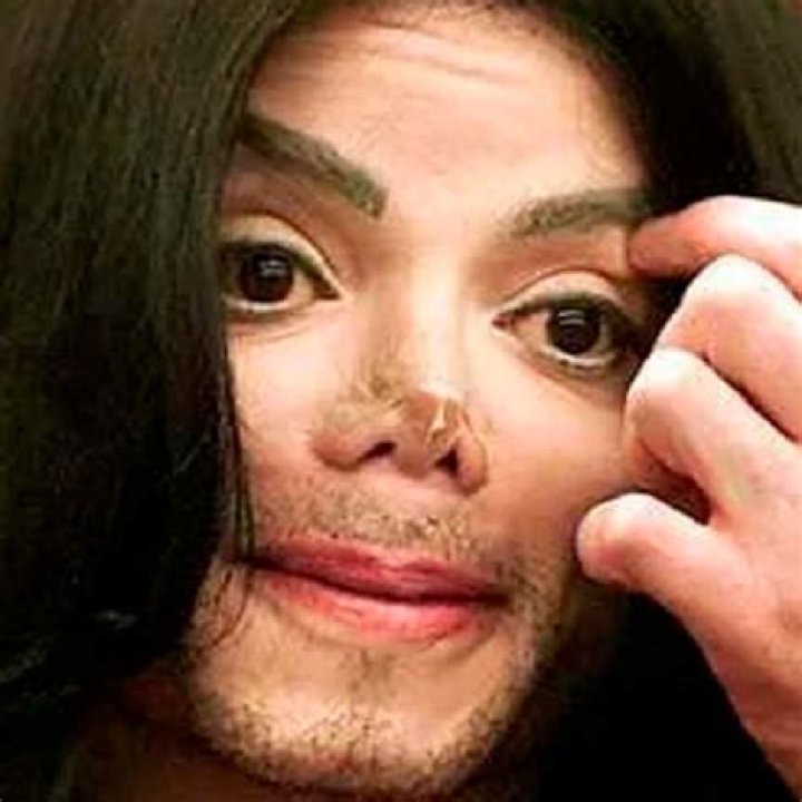 Why Michael Jackson Nose Became a Topic of Interest